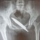 American Man Stabbed In Ass In Qianmen