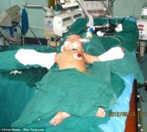Grandmother Chops Off Eight-Month-Old Granddaughter’s Hands