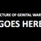 Today In Terribly Unfortunate STD Contractions [UPDATE]