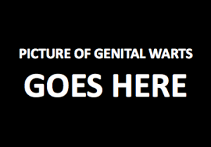 Genital warts