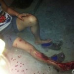 Li Jianbo-caused injuries featured image