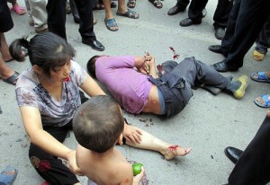 Nanning cop accident - the injured