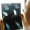 17-Year-Old In Fujian, Ashamed Of Getting Erections, Turns To Self-Castration