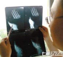 17-Year-Old In Fujian, Ashamed Of Getting Erections, Turns To Self-Castration