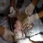 Baby rescued from toilet