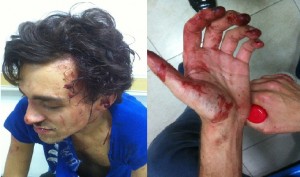 French expat beaten up in Shanghai