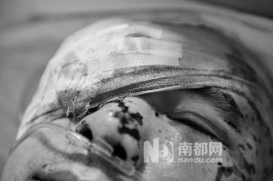 Li Jianxin wounded by acid and knives